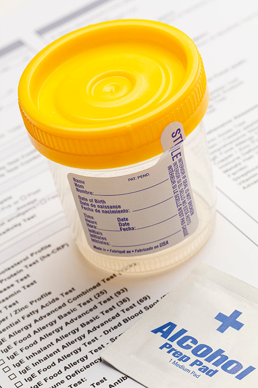 WHAT EVERY ATHLETE SHOULD KNOW ABOUT CBD AND DRUG TESTING